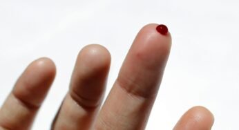 Most Common Blood Clot Myths