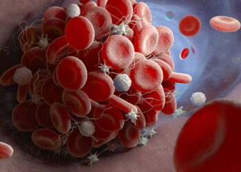 Cancer-Associated Venous Thromboembolism