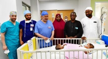 Saudi Medical Team Successfully Separates Nigerian Conjoined Twins