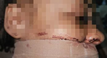 PHOTOS: Police Rescue Woman From Suspected Ritualist In Abuja Hotel