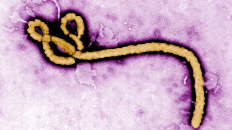 FG Confirms Ebola Case in FCT